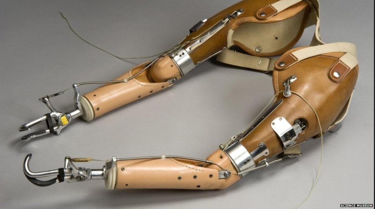 Bionic prosthesis Arm