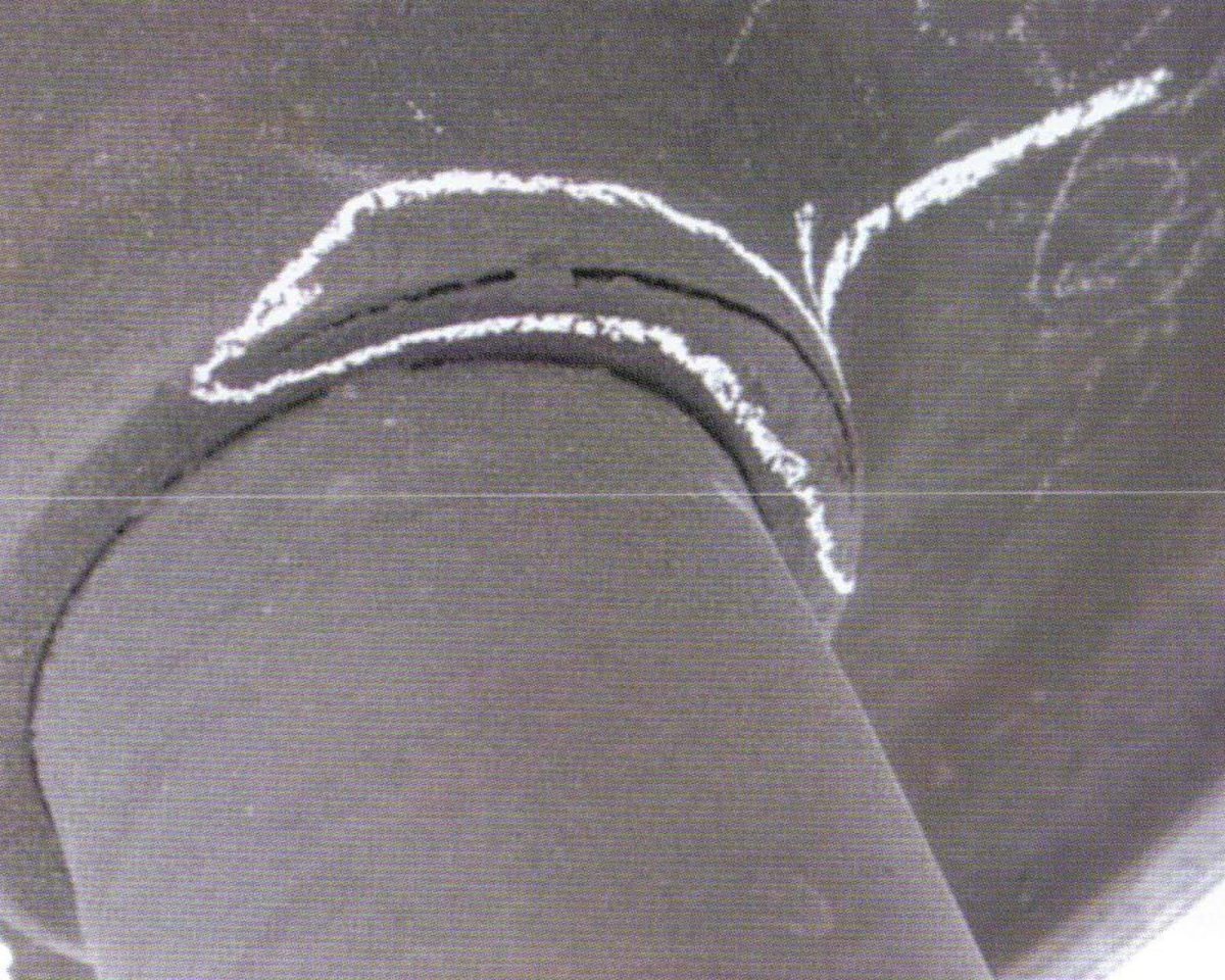 Трещина обода колесной пары