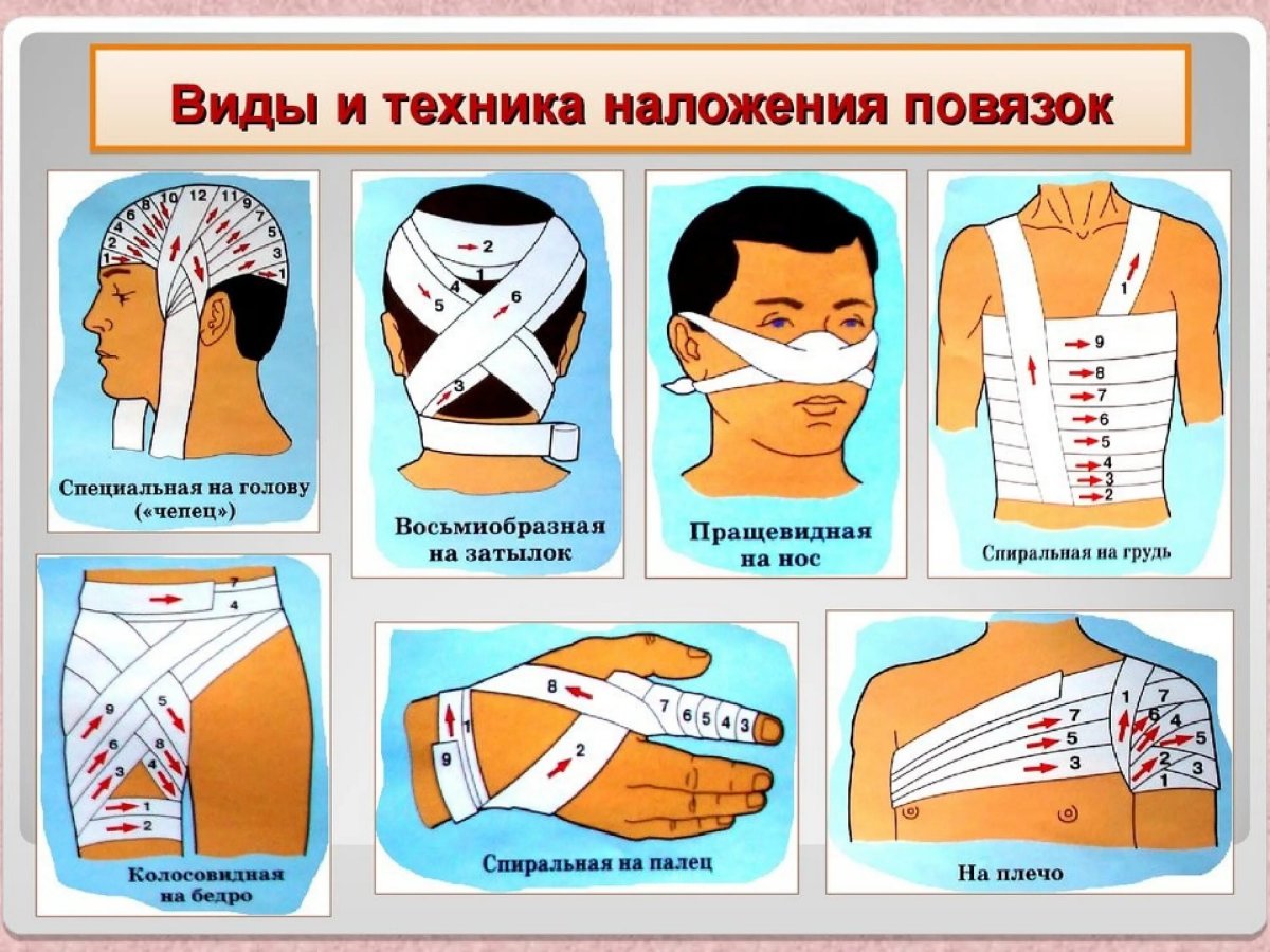 Повязки (правила наложения, виды, схемы)