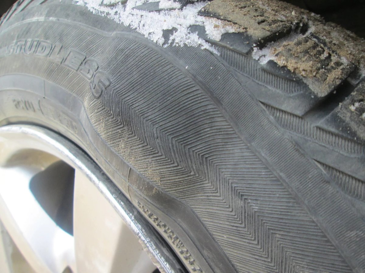 Грыжа шина Кама